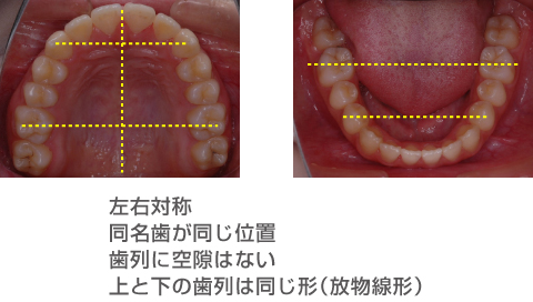 左右対称,同名歯が同じ位置,歯列に空隙はない,上と下の歯列は同じ形（放物線形）の写真